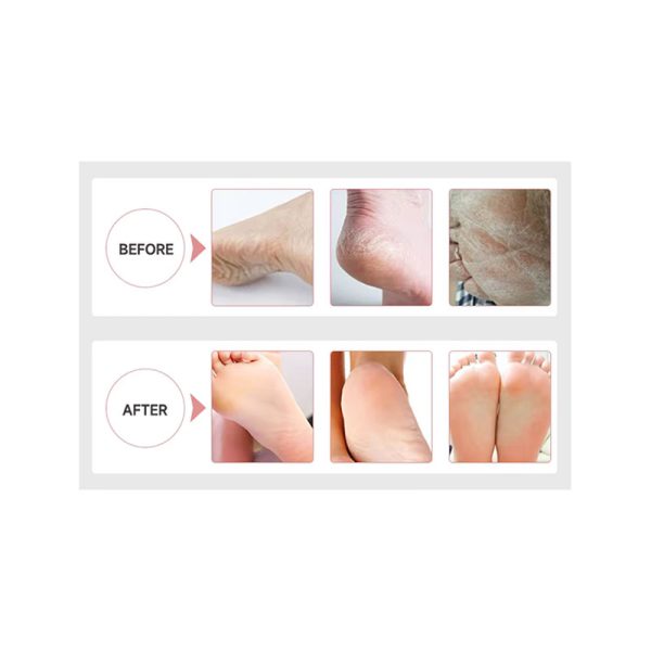 Crystals Jelly Spa Foot Bath Salt - Gói ngâm chân tẩy tế bào chết